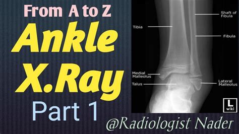 اوضاع تصوير الكاحل بالاشعة العادية مع التشريحالجزء الاول Ankle Xray