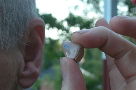 Cochlear Implants Improve Hearing In Older Adults With No Side Effects