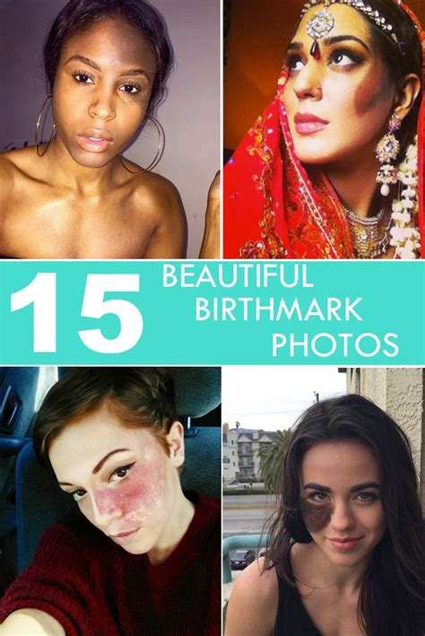 15 Photos That Prove That Birthmarks Are Beautiful Birthmark Port