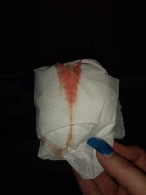 Is This Implantion Bleeding Or Period It Has Alot Of Clear Mucus In It