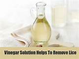 Home Remedies Lice Listerine Vinegar