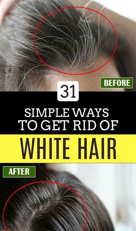 Simple Ways To Get Rid Of White Hair Remedy For White Hair Grey Hair