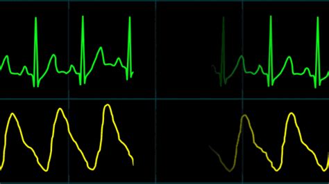 EKG Display Monitor On Behance Dj Art Ekg Heart Rate Cool Gifs
