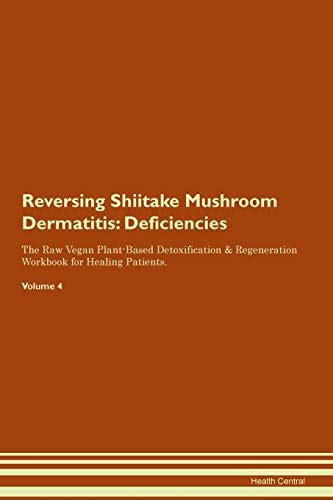 Reversing Shiitake Mushroom Dermatitis De Central Health Iberlibro