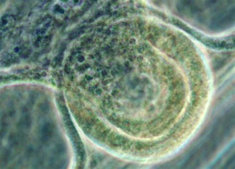 Aurelia Ephyra Stage Jellyfish Nikons Microscopyu