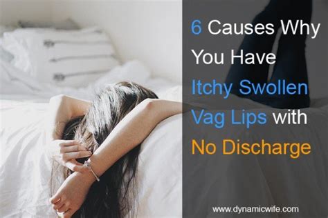 6 possible causes why you have itchy swollen vaginal lips with no discharge