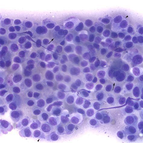 Discrete Cell Tumors EClinpath