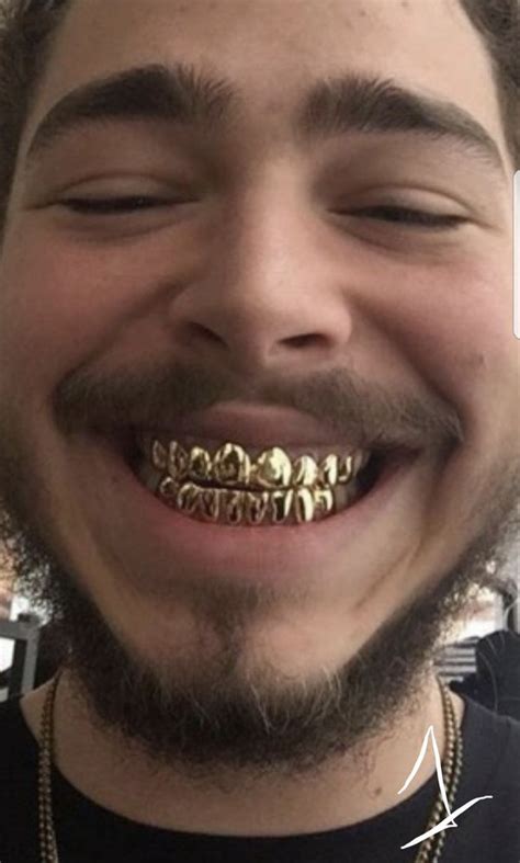 Mouth Grillz For Sale In Los Angeles CA OfferUp Mouth Grillz
