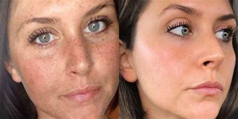 Best raisin filled cookie recipe : This Woman's Reddit Before-And-After Sun Damage Photo Is ...