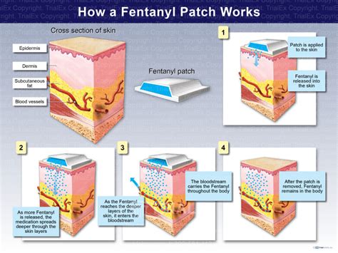 How A Fentanyl Patch Works Trial Exhibits Inc