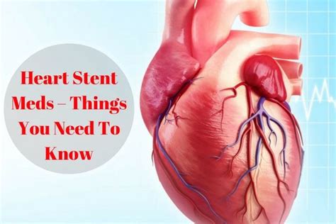 Pin On Heart Stent Meds Things You Need To Know