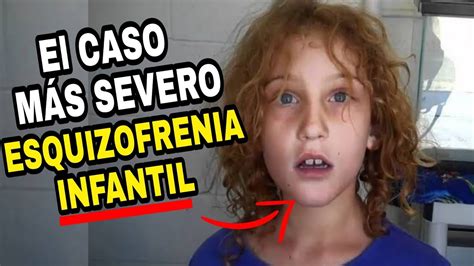 El CASO De ESQUIZOFR N INFANTIL Más SEVERO JANI SCHOFIELD YouTube