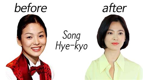 Song Hye Kyo Before And After Youtube