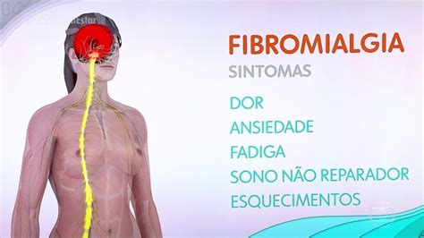 O Que é Fibromialgia Sintomas Tratamentos Cura E Mais