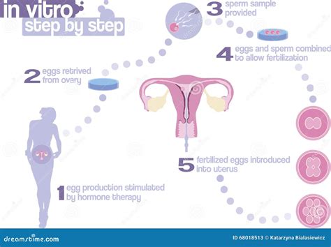 In Vitro Fertilization Step By Step Stock Image Image Of Steps Ovary