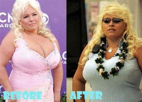 beth chapman plastic surgery before and after pictures lovely surgery