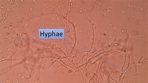 Yeast Cell And Hyphae Under The Microscope Youtube