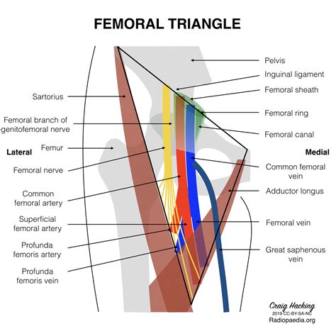 Radiopaedia Drawing Contents And Boundaries Of The Femoral Triangle