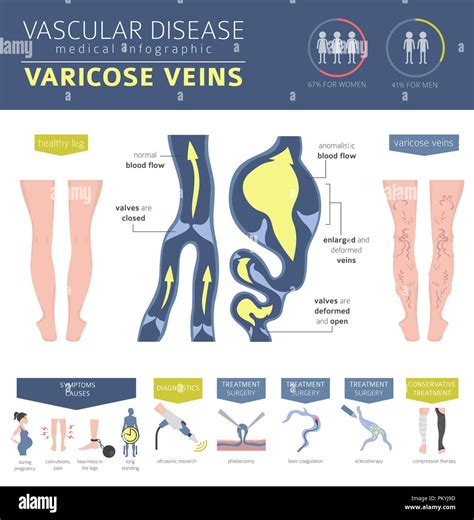 Vascular Diseases Varicose Veins Symptoms Treatment Icon Set Medical