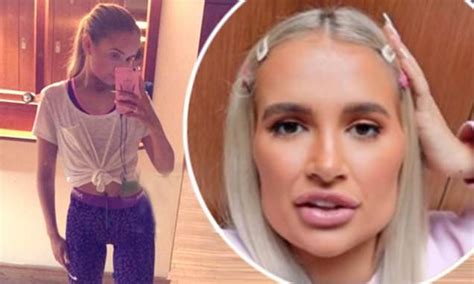 Molly Mae Hague Regrets Lip Filler And Underweight Snap