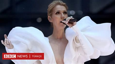 Katı Kişi Sendromu Celine Dion Un Yakalandığı Hastalık Nedir Bbc News Türkçe