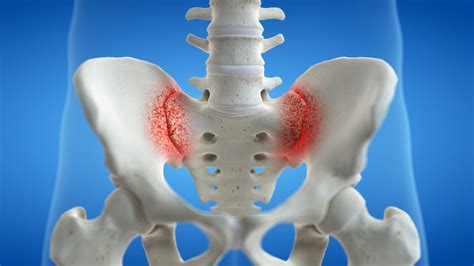 Sacroiliac Joint Injection For Low Back And Buttock Pain Arizona Pain