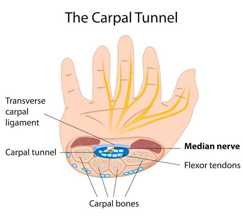 Explainer What Is Carpal Tunnel Syndrome And What Happens If I Get It