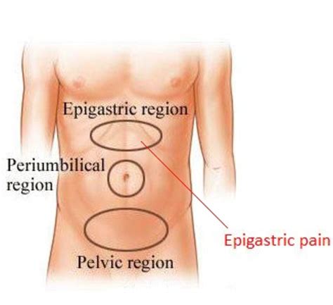 Epigastric Pain Location Causes And Treatment Hubpages