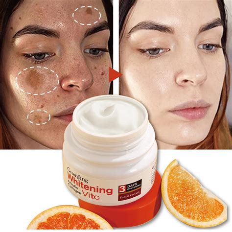 Whitening Freckle Cream Remove Melasma Dark Spot Lightening Melanin Brightening Melasma Remover