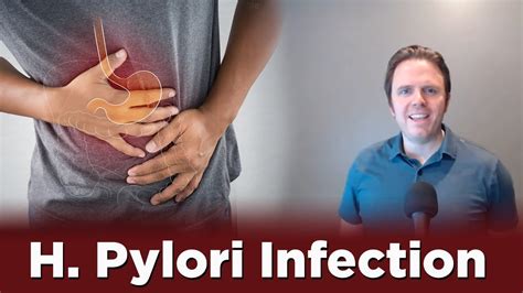 H Pylori Infection Dr J Q A YouTube