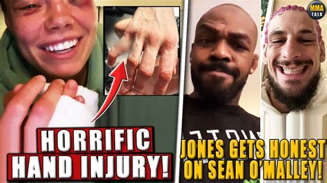Rose Namajunas Shows Off Horrific Hand Injury Jon Jones Gets Honest On