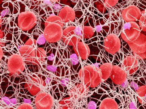 Диета и соэ Piastrine o Trombociti: Alte, Basse e Valori di riferimento nel Sangue Piastrine o Trombociti: Alte, Basse e Valori di riferimento nel Sangue Диета и соэ
