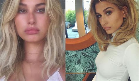 Hailey Baldwin Opens Up About Plastic Surgery Rumours