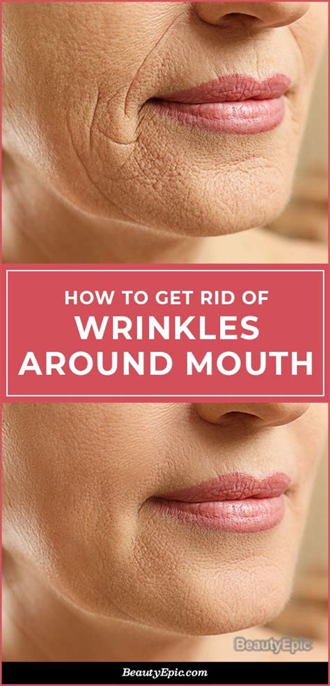 4 Ways To Get Rid Of Wrinkles Around Mouth Naturally Face Wrinkles Home Remedies For Wrinkles