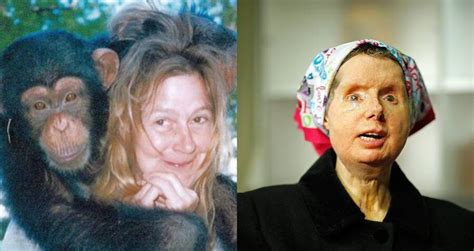 The Disturbing Story Of Charla Nash The Woman Whose Face Was Ripped Off By An Enraged
