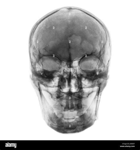 Human Skull Anterior View Black And White Stock Photos And Images Alamy