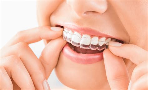 Am I Too Old For Braces The Truth About Adult Orthodontics Branches