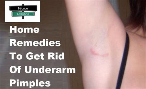 Home Remedies Home Remedies To Get Rid Of Underarm Pimples Ways To
