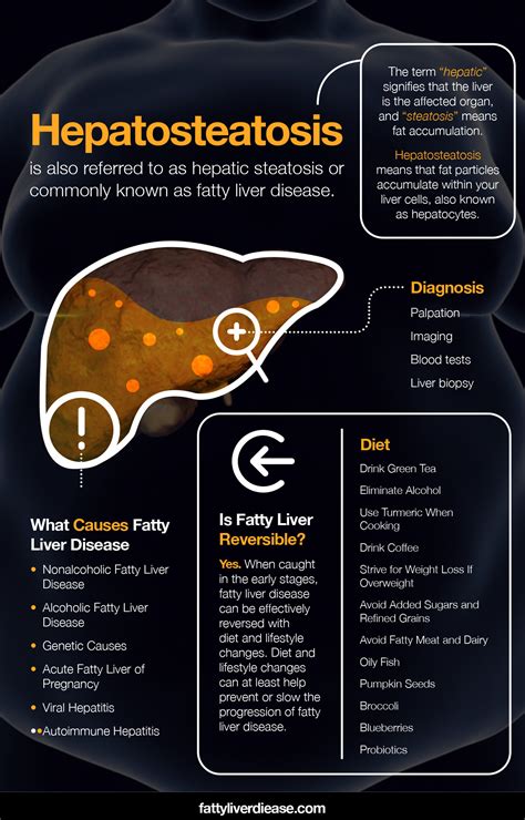Hepatosteatosis What You Can Do About It Fatty Liver Disease