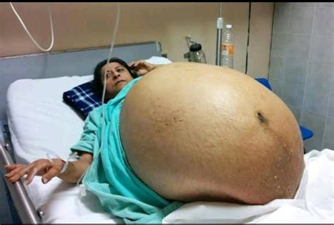 Photos Of Biggest And Scariest Baby Bumps 9jainformed