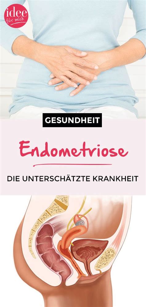 Veja remédios, o diagnóstico, tratamentos e se a doença tem cura. Diagnose Endometriose: Die unterschätzte Krankheit ...