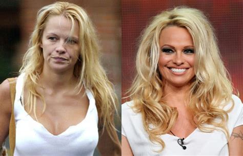 Famous Drug Addicts Before And After Pictures TSMP Medical Blog