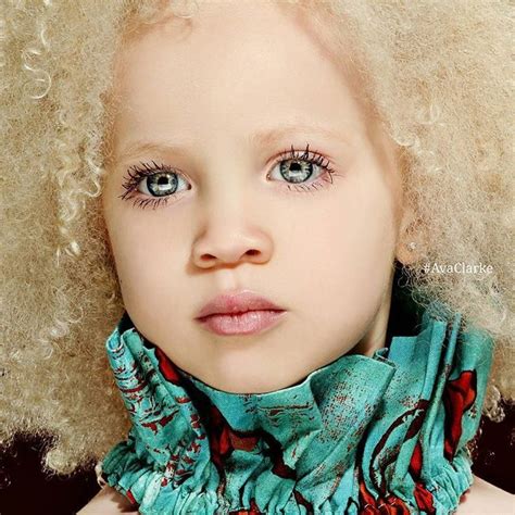 Niña albina africana desnuda Fotos de mujeres