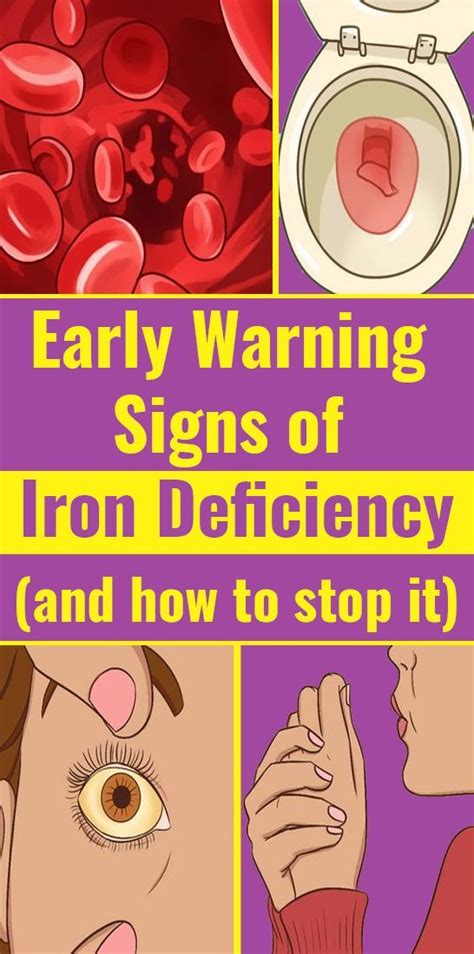 Never Ignore These Crucial Signs Of Iron Deficiency Your Health