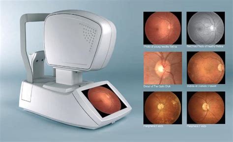 Optometrists Fremont Eye Centre Port Coquitlam Eye Exam