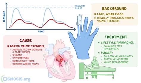 Pulsus Parvus Et Tardus What Is It Causes And More Osmosis