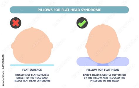 Craniosynostosis Helmet Pillow Flat Head Autism Brain Skull Bone