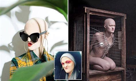 Model With Rare Genetic Disorder Says Shes Earned Respect With Images Rare Genetic