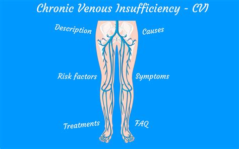 Chronic Venous Insufficiency Cvi Treatments Symptoms Causes Doctor Brace