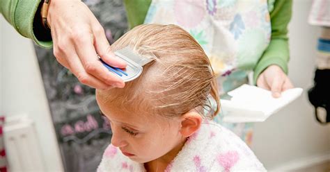 Head Lice Infestation Causes Symptoms And Diagnosis